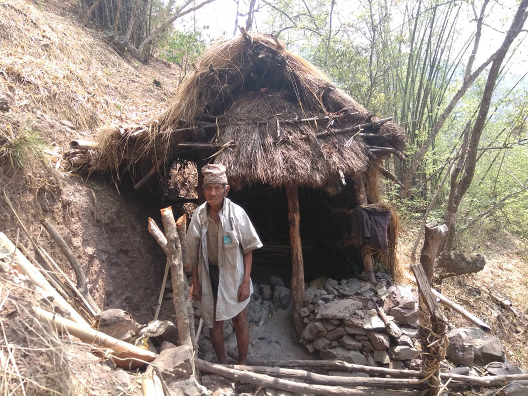 कुष्ठरोग लागेपछि गाउँबाट लखेटे गाउँलेले